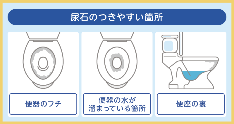 尿石のつきやすい箇所